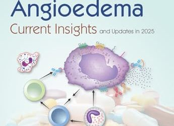 Urticaria and Angioedema Current Insights and Updates in 2025, 2nd edition