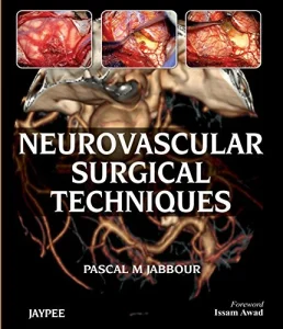 Neurovascular Surgical Techniques