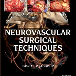 Neurovascular Surgical Techniques