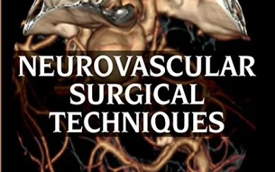 Neurovascular Surgical Techniques