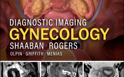 Diagnostic Imaging: Gynecology 4th Edition