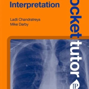 Pocket Tutor: Chest X-Ray Interpretation, 2nd Edition
