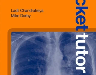 Pocket Tutor: Chest X-Ray Interpretation, 2nd Edition