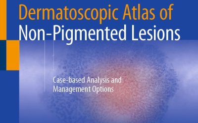 Dermatoscopic Atlas of Non-Pigmented Lesions