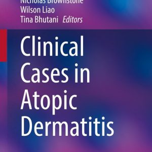 Clinical Cases in Atopic Dermatitis