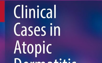 Clinical Cases in Atopic Dermatitis