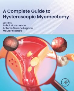 A Complete Guide to Hysteroscopic Myomectomy 1st Edition