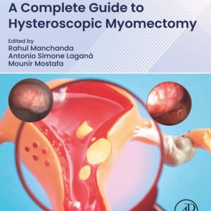 A Complete Guide to Hysteroscopic Myomectomy 1st Edition