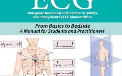 ABC of ECG