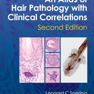 An Atlas of Hair Pathology with Clinical Correlations, 2nd Edition