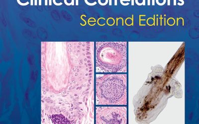 An Atlas of Hair Pathology with Clinical Correlations, 2nd Edition