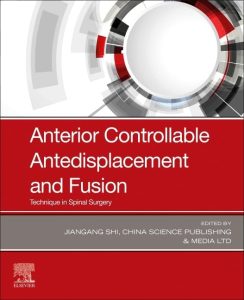 Anterior Controllable Antedisplacement and Fusion: Technique in Spinal Surgery 1st Edition
