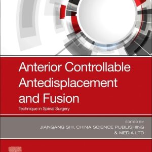 Anterior Controllable Antedisplacement and Fusion: Technique in Spinal Surgery 1st Edition