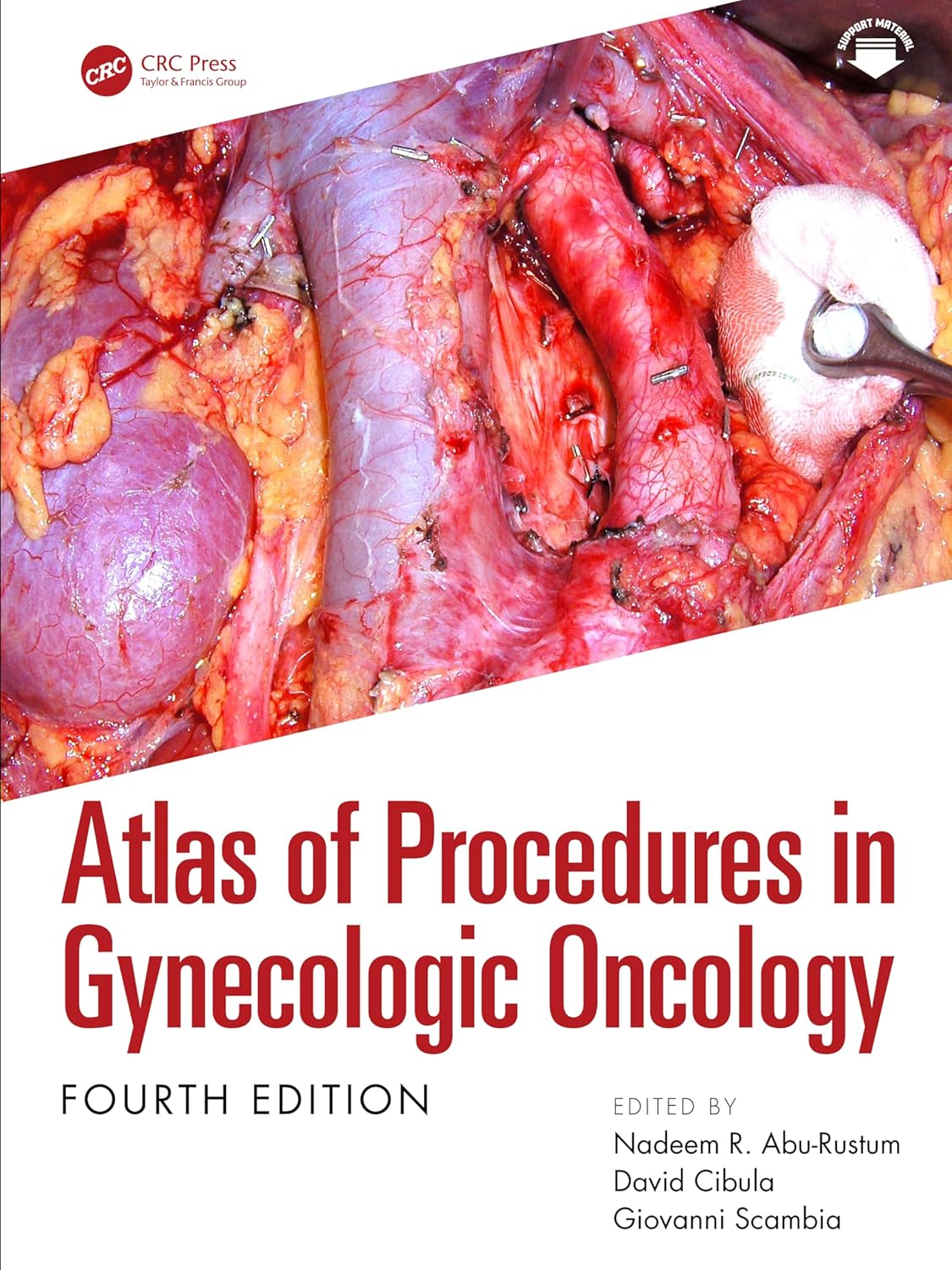 Atlas of Procedures in Gynecologic Oncology 4th Edition