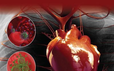 COVID-19’s Consequences on the Cardiovascular System: Immediate, Intermediate, and Long-Term Complications 1st Edition
