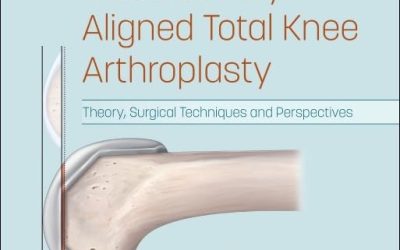 Calipered Kinematically aligned Total Knee Arthroplasty: Theory, Surgical Techniques and Perspectives 1st Edition