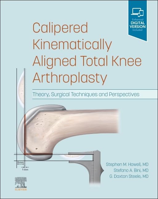Calipered Kinematically aligned Total Knee Arthroplasty Theory, Surgical Techniques and Perspectives Calipered Kinematically aligned Total Knee Arthroplasty: Theory, Surgical Techniques and Perspectives 1st Edition
