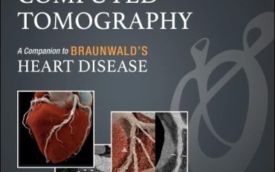 Cardiac Computed Tomography: A Companion to Braunwald’s Heart Disease