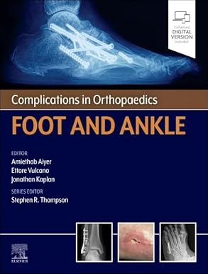 Complications in Orthopaedics Foot and Ankle