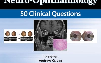 Consultations in Neuro-Ophthalmology: 50 Clinical Questions (Curbside Consultation in Ophthalmology) 3rd Edition
