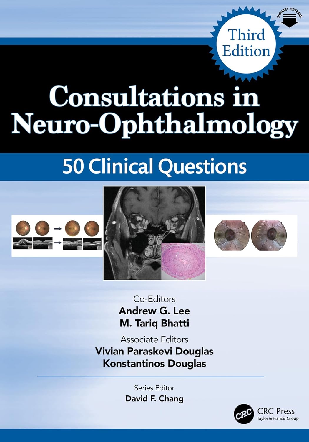 Consultations in Neuro-Ophthalmology 50 Clinical Questions Consultations in Neuro-Ophthalmology: 50 Clinical Questions (Curbside Consultation in Ophthalmology) 3rd Edition