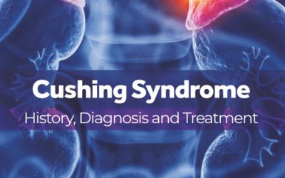 Cushing Syndrome: History, Diagnosis and Treatment 1st Edition