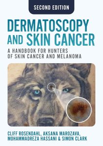 Dermatoscopy and Skin Cancer, second edition (2nd Edition)