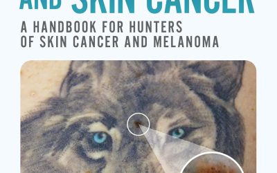 Dermatoscopy and Skin Cancer, second edition (2nd Edition)