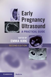 Early Pregnancy Ultrasound: A Practical Guide 2nd Edition