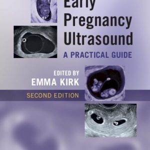 Early Pregnancy Ultrasound: A Practical Guide 2nd Edition