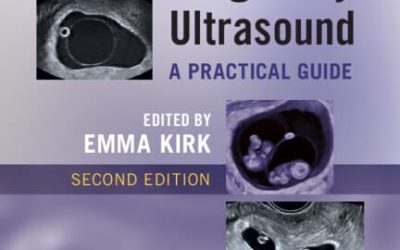 Early Pregnancy Ultrasound: A Practical Guide 2nd Edition