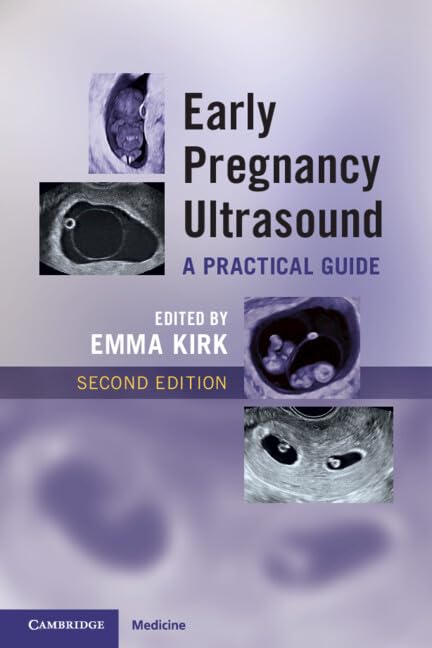 Early Pregnancy Ultrasound A Practical Guide Early Pregnancy Ultrasound: A Practical Guide 2nd Edition