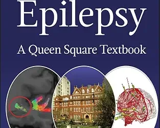 Epilepsy: A Queen Square Textbook