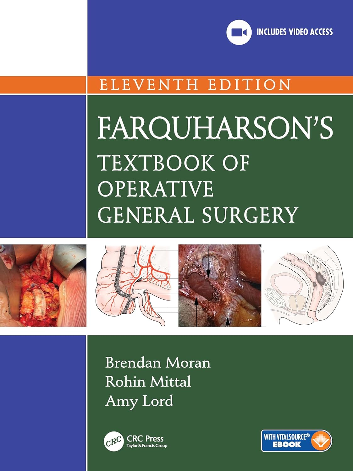 Farquharson’s Textbook of Operative General Surgery – 11th edition