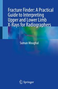 Fracture Finder A Practical Guide to Interpreting Upper and Lower Limb X-Rays for Radiographers