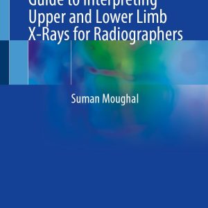 Fracture Finder A Practical Guide to Interpreting Upper and Lower Limb X-Rays for Radiographers