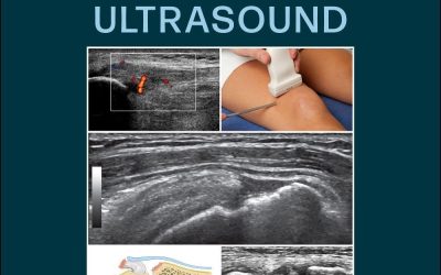 Fundamentals of Musculoskeletal Ultrasound (Fundamentals of Radiology) 4th Edition