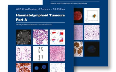Haematolymphoid Tumours WHO Classification of Tumours – 5th edition