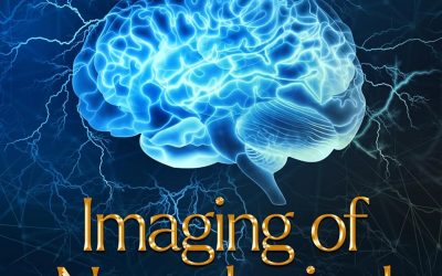 Imaging of Neurological Diseases (Neurology – Laboratory and Clinical Research Developments)
