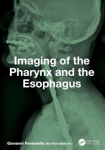 Imaging of the Pharynx and the Esophagus 1st Edition