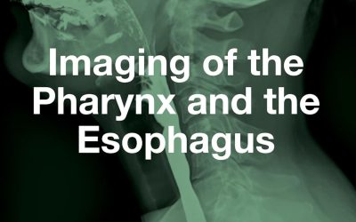 Imaging of the Pharynx and the Esophagus 1st Edition