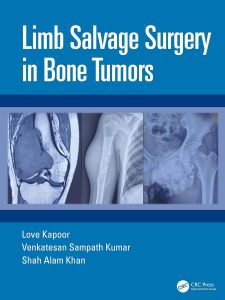Limb Salvage Surgery in Bone Tumors 1st Edition