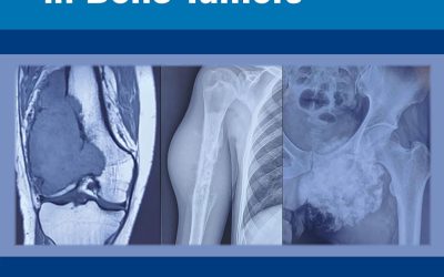 Limb Salvage Surgery in Bone Tumors 1st Edition