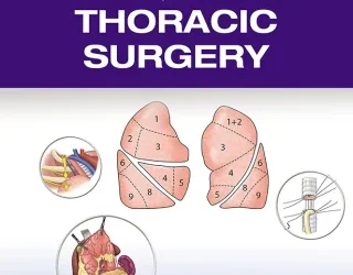 Massachusetts General Hospital Illustrated Tips and Tricks in Thoracic Surgery