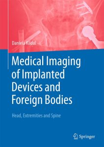 Medical Imaging of Implanted Devices and Foreign Bodies Head, Extremities and Spine