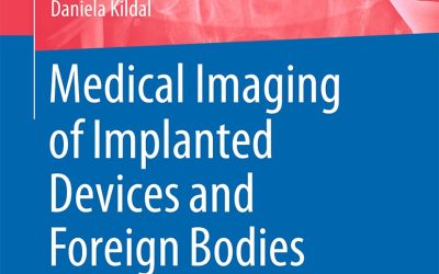 Medical Imaging of Implanted Devices and Foreign Bodies Head, Extremities and Spine
