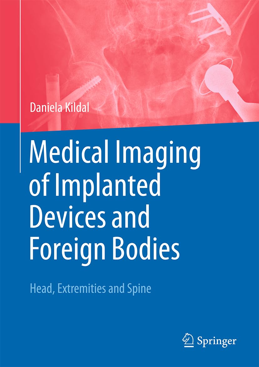 Medical Imaging of Implanted Devices and Foreign Bodies Head, Extremities and Spine