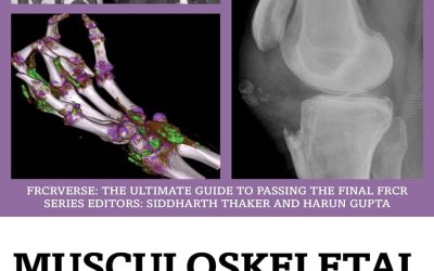 Musculoskeletal Radiology: An Ultimate Guide to Passing the Final FRCR (FRCRverse) 1st Edition