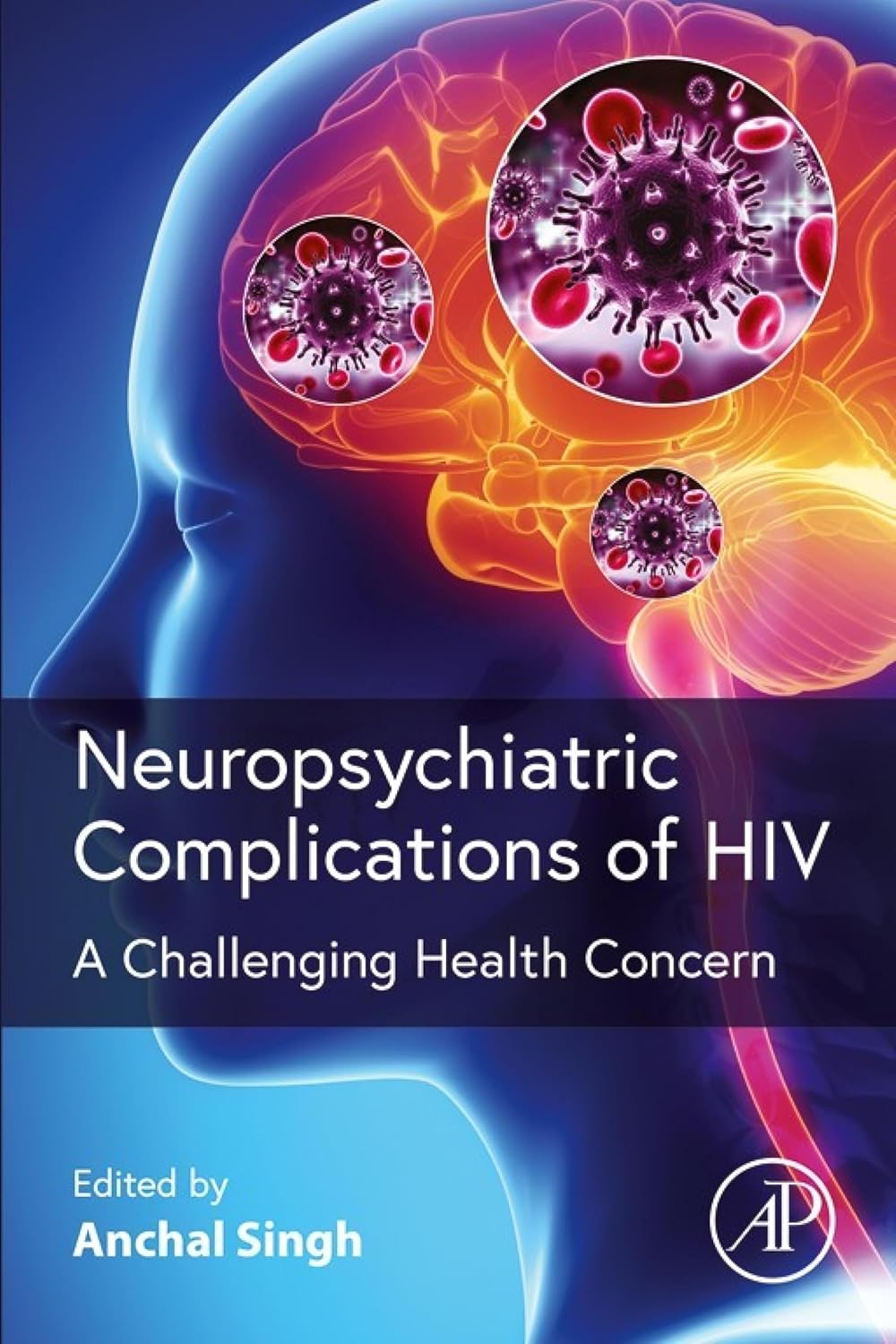 Neuropsychiatric Complications of HIV A Challenging Health Concern Neuropsychiatric Complications of HIV: A Challenging Health Concern 1st Edition