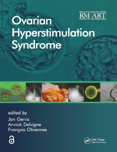 Ovarian Hyperstimulation Syndrome (Reproductive Medicine and Assisted Reproductive Techniques Series Book 1) 1st Edition